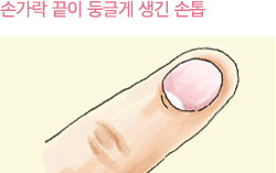 손가락 끝이 둥글게 생긴 손톱 이미지